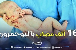 «16 ألف حالة إصابة بالبوحمرون منذ بداية السنة»
