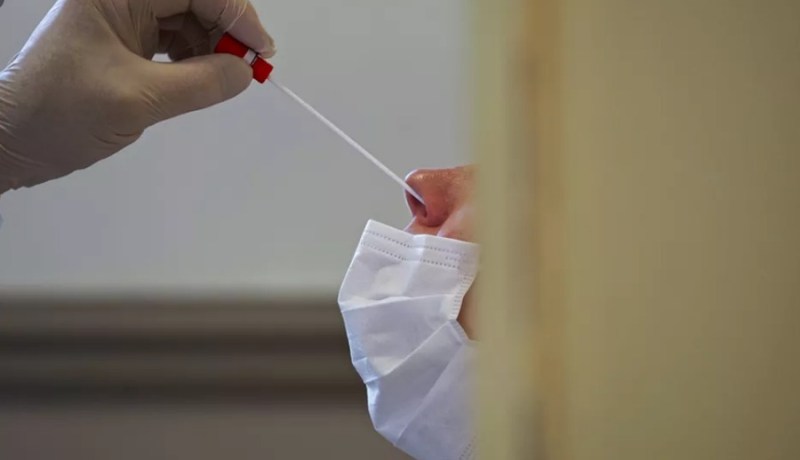 فحص pcr بـ 7800 دج وهذه المخابر التي تجريه