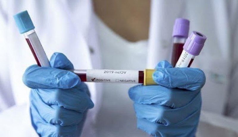 أدرار: وضع حيز الخدمة جهاز pcr بالمستشفى الجديد عبد الكريم بودرغومة