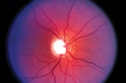 خلايا جذعية تتحول إلى أنسجة تعيد البصر للمكفوفين