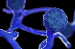 وزارة الصحة المصرية تطلق هذه التحذيرات حول مرض الفطر الأسود