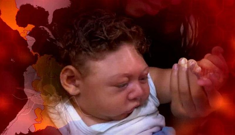 زيكا يحصد أرواح 139 طفلا في البرازيل