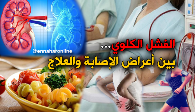 الفشل الكلوي وكيفية تفاديه