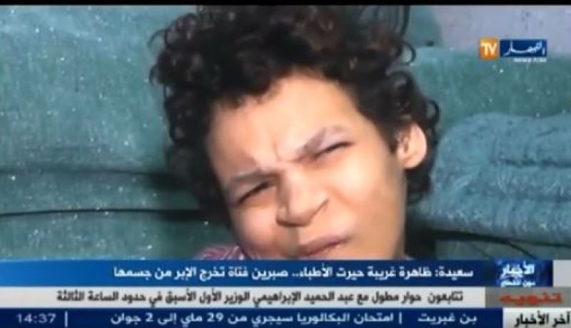 بالفيديو فتاة من الجزائر تخرج الإبر من جسمها