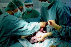 لهذه الأسباب ارتفعت نسبة الولادات القيصرية بالجزائر