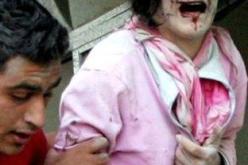 أحياء لم ينزفوا دما ولكن أطرافهم تبدوا مقطعة بأمواس حادة