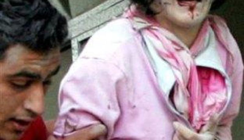 أحياء لم ينزفوا دما ولكن أطرافهم تبدوا مقطعة بأمواس حادة