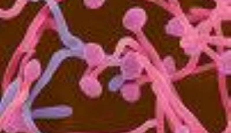 الرجال أكثر عرضة للالتهابات من النساء