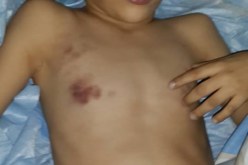 عون تخدير تحقن طفلا بجرعة زائدة وتتسبب في وفاته بمستشفى مصطفى باشا