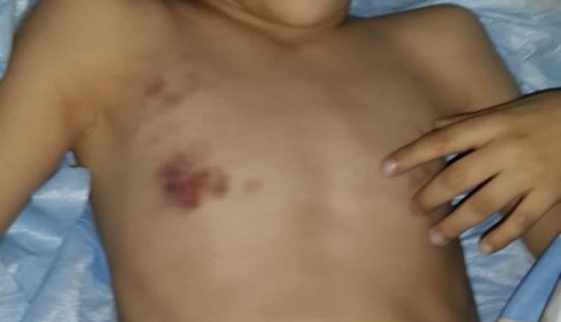 عون تخدير تحقن طفلا بجرعة زائدة وتتسبب في وفاته بمستشفى مصطفى باشا