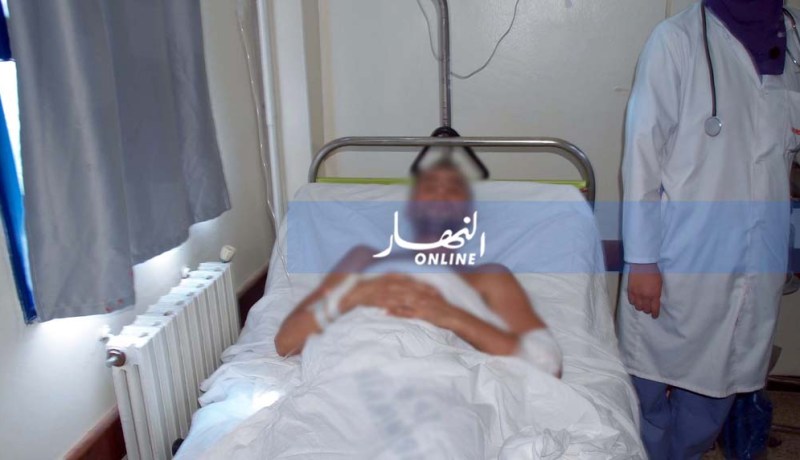 قاصر يعتدي على جاره الثلاثيني ببندقية في وهران
