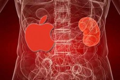 يبيع كليته مقابل شراء هاتف آيفون