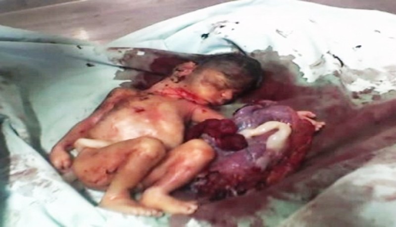 زوجان متخصّصان في طب التوليد يحوّلان منزلهما إلى عيادة سرية للإجهاض ببوزريعة