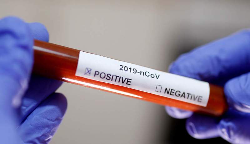 كورونا.. 13 ولاية لم تسجل بها أي حالة جديدة