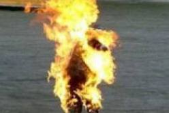 وفاة ثاني منتحر متأثرا بحروق من الدرجة الثالثة في وهران