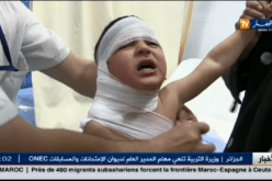 عشية المولد النبوي أطفال في المستشفيات بحروق بليغة