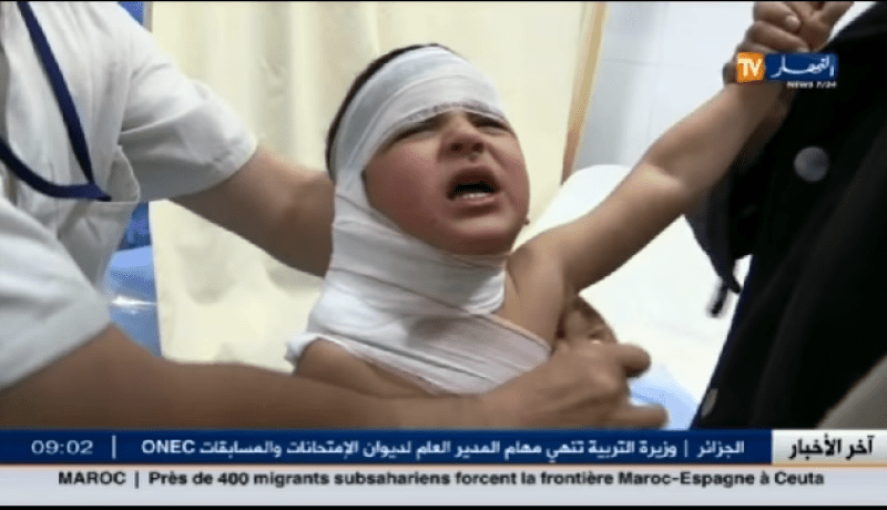 عشية المولد النبوي أطفال في المستشفيات بحروق بليغة