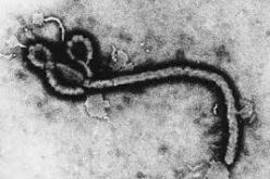 مختص في علم الأوبئة يقلل من احتمال انتقال فيروس ايبولا إلى الجزائر