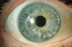 معهد باستور يكشف عن تـــوفيــــر نسيـــج القرنيـــة بالجزائـــر قريبــــا