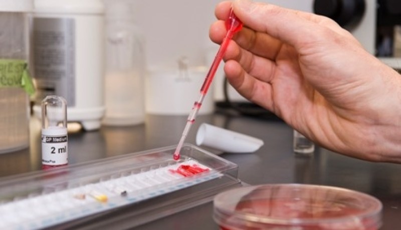 تسجل 49 حالة إصابة بالحمى المالطية البشرية منذ جويلية الفارط  في البويرة