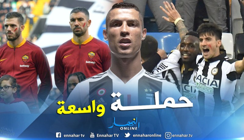 لهذا السبب وضع لاعبو “الكالتشيو” علامات حمراء على وجوههم
