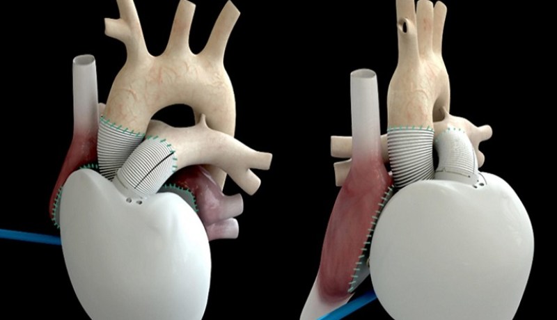 بشرى لمرضى القلب
