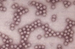 أعوان الشّرطة والحماية الأكثر عرضة للإصابة بالتهاب الكبد الفيروسي