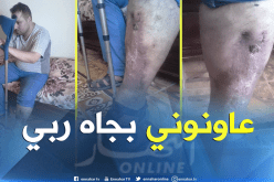 بالصور….خطأ طبي يحوّل حياة ياسين زغود إلى جحيم