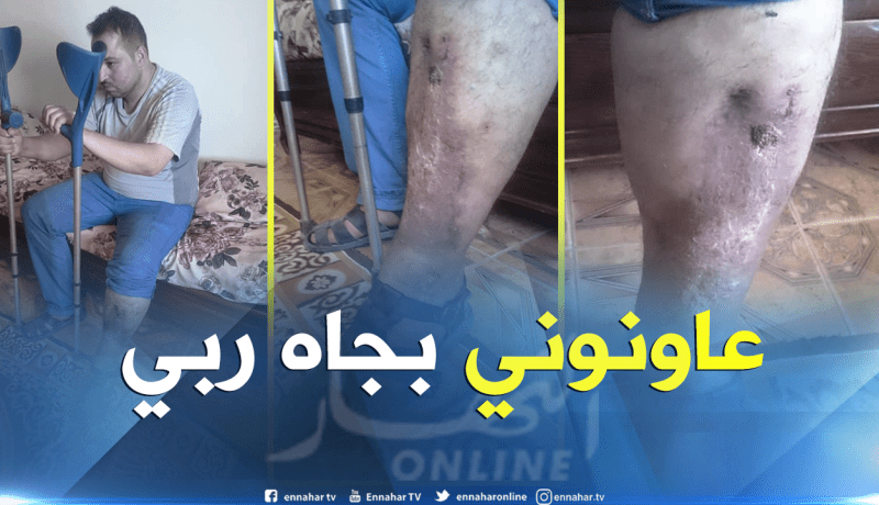 بالصور….خطأ طبي يحوّل حياة ياسين زغود إلى جحيم