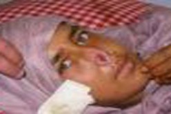 لزواجها من رجل آخر .. رجل يقطع أنف زوجته السابقة