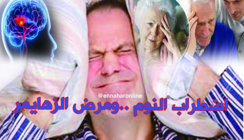 اضطراب النوم يؤدي للإصابة بالزهايمر