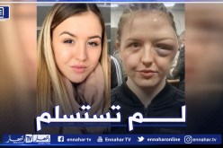 المُلاكمة الألمانية “هاسنون” تفوز بنزالها رغم إصابتها المُرعبة !