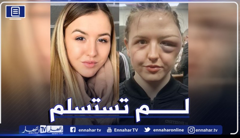 المُلاكمة الألمانية “هاسنون” تفوز بنزالها رغم إصابتها المُرعبة !