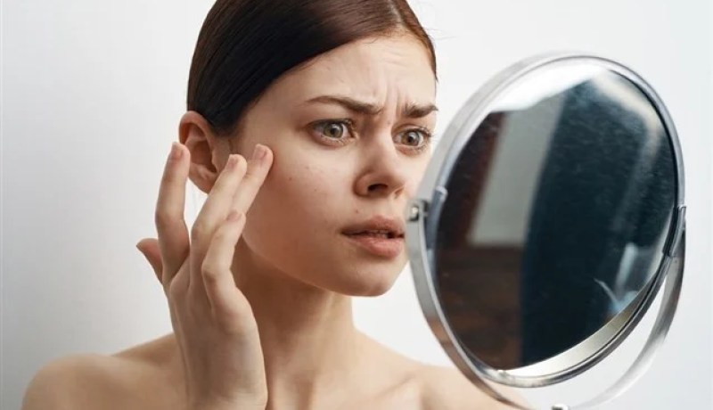 تفسير رؤيا العلة في الوجه ودلالتها في المنام