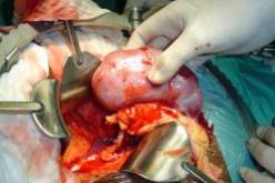 أكثر من 3500 إصابة جديدة بإمراض الكلى سنويا