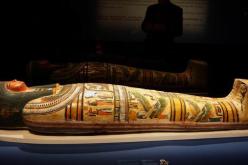 اكتشاف أقدم حالة سرطان ثدي في العالم