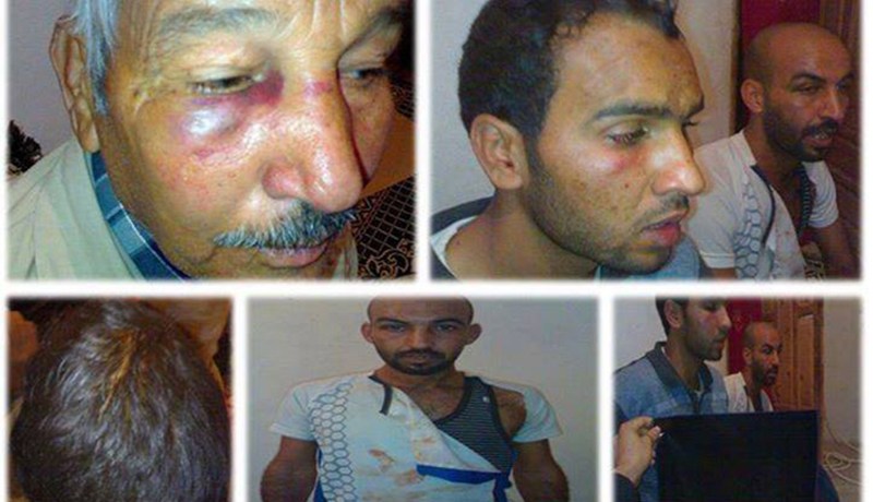شــرطي يعــتدي عـلى شابــين ووالـدهــمـا وزمـلاؤه يشبعـونهم ضربـا في الأغــواط