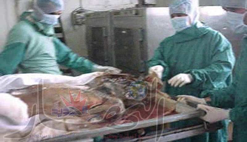 الشعـــوذة‮.. ‬في‮ ‬المستشفيــــــــــات