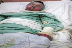 ‮ ‬الطالب الذي‮ ‬أحرق نفسه في‮ ‬تيارت في‮ ‬حالة خطيرة