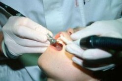 ‮''‬صنايعية‮'' ‬يمارسون مهنة طب الأسنان في‮ ''‬الڤاراجات‮''‬