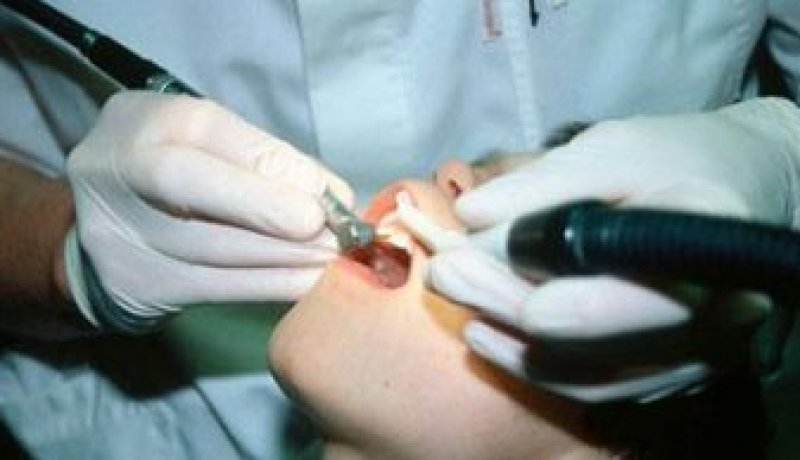 ''صنايعية'' يمارسون مهنة طب الأسنان في ''الڤاراجات''
