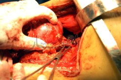 ''كـلى'' فرنسية للحصـول على بطاقة الإقـامة.. !