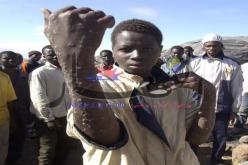 الملاريا فتكت بـ480 جزائري خلال سنة 2012