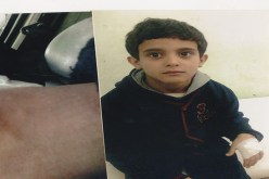 أستاذة تصيب يد تلميذ بمقص بسبب ممحاة في العاصمة