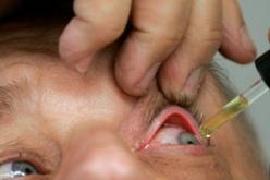 تسجيل ألف إصابة بالرمد الحبيبي في المستشفيات