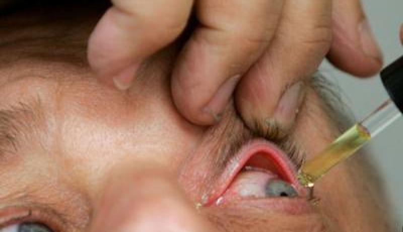 تسجيل ألف إصابة بالرمد الحبيبي في المستشفيات