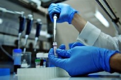 مخابر تتعمّد عدم الإعلان عن حالات الإصابة بالسيدا المكتشفة