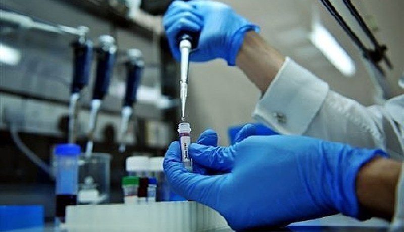 مخابر تتعمّد عدم الإعلان عن حالات الإصابة بالسيدا المكتشفة