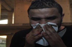 الإصابة بالتهاب جيوب الأنف قد تتحول إلى ربو