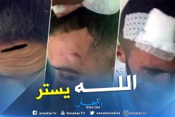 بالصور.. إصابات في صفوف “الشناوة” بعد نهاية مباراة بلعباس